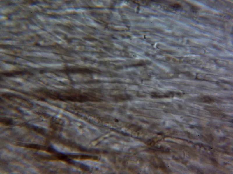 Amanita excelsa 10 - Subpellis agua 1